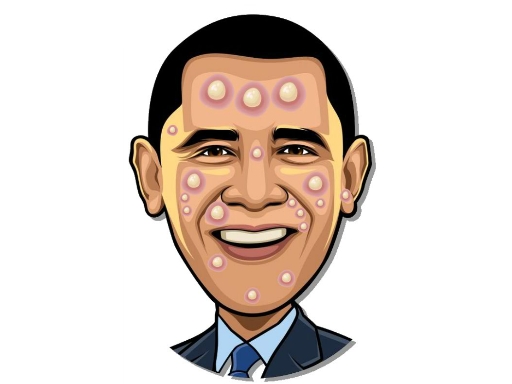 Celebrity Pimple Pop_img